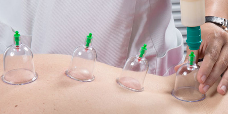 Cupping on patient