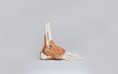 I Have Heel Pain/Plantar Fasciitis… What Can I Do About It??