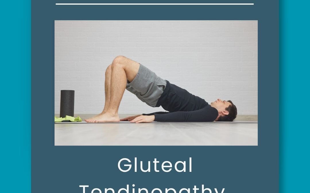 Gluteal Tendinopathy: The Who, What, When, Where & Why
